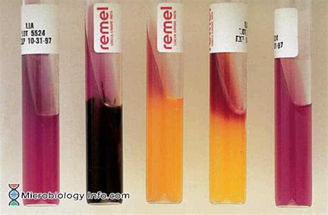 Lysine Iron Agar (LIA) Slants Test .